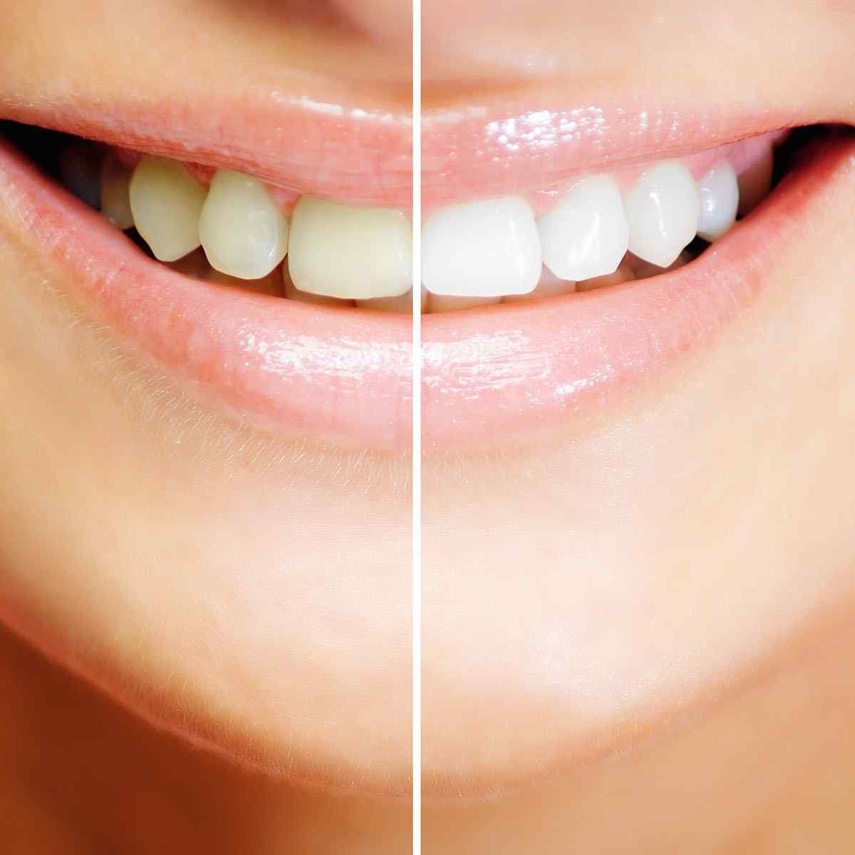 COSMETIC SERVICES | Quality Dental Care