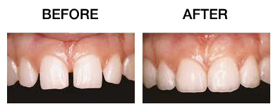 COSMETIC SERVICES | Quality Dental Care