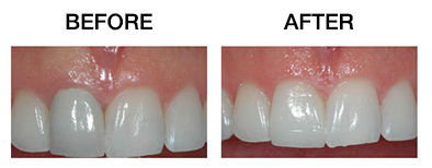 COSMETIC SERVICES | Quality Dental Care