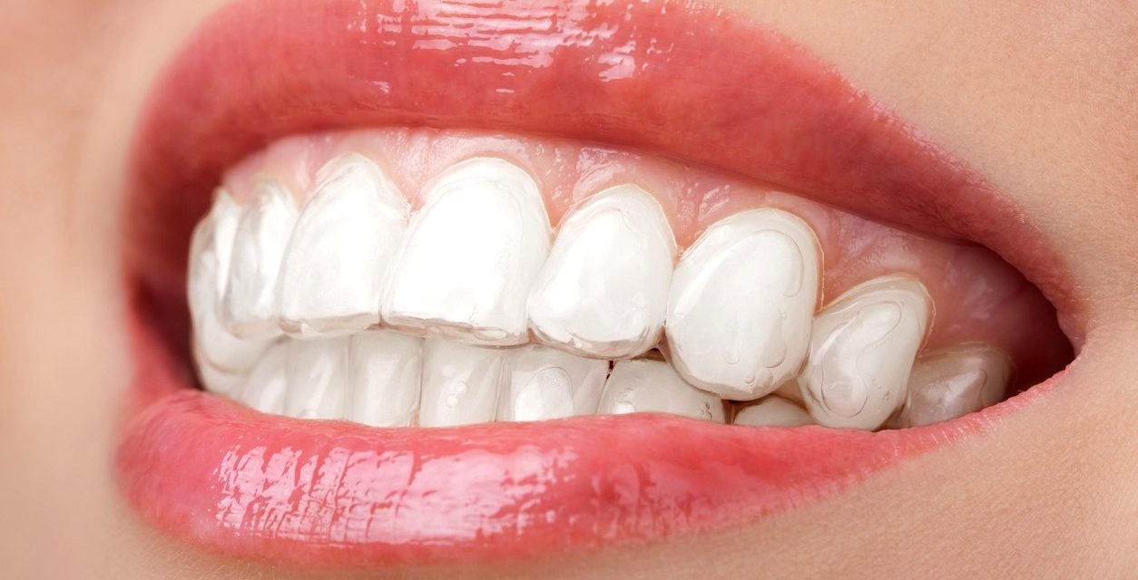 https://clone.qualitydentalcare.com.au/wp-content/uploads/2021/11/0_wz88WSJ0tPsYqtU0-1254x640.jpg