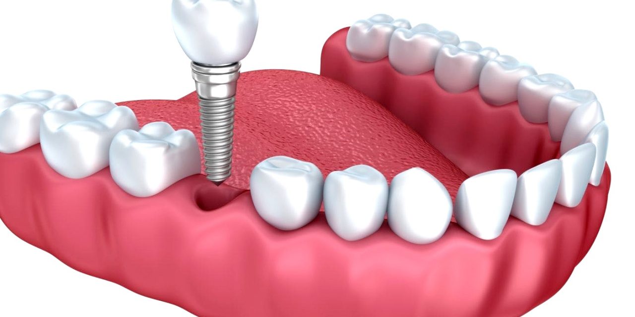 https://clone.qualitydentalcare.com.au/wp-content/uploads/2021/12/ThinkstockPhotos-537432362_200930_161758-1280x640.jpg